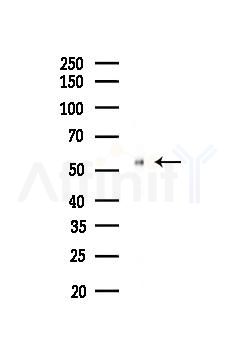 Phospho-Smad2 (Ser250) Recombinant Rabbit mAb - Western blot analysis of lysates from B16F10-LUC cells(heat-shock,45min treatment), using Phospho-Smad2 (Ser250) Recombinant Rabbit mAb at 1/1000 dilution.