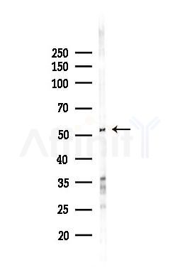Smad2 Recombinant Rabbit mAb - Western blot analysis of lysates from Hela cells(heat-shock,45min treatment), using Smad2 Recombinant Rabbit mAb at 1/1000 dilution.