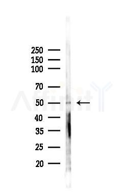Smad2 Recombinant Rabbit mAb - Western blot analysis of lysates from B16F10-LUC cells(starvation,24h treatment), using Smad2 Recombinant Rabbit mAb at 1/1000 dilution.