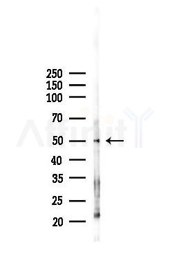 Smad2 Recombinant Rabbit mAb - Western blot analysis of lysates from PC12 cells(LPS,4h treatment), using Smad2 Recombinant Rabbit mAb at 1/1000 dilution.