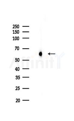 Phospho-Smad2/3 (Thr8) Recombinant Rabbit mAb - Western blot analysis of lysates from Hela cells(LPS,4h treatment), using Phospho-Smad2/3 (Thr8) Recombinant Rabbit mAb at 1/1000 dilution.
