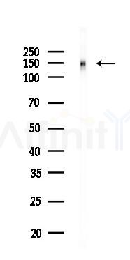 IL17RA Recombinant Rabbit mAb - Western blot analysis of lysates from Hela cells(LPS,4h treatment), using IL-17RA Receptor Recombinant Rabbit mAb at 1/1000 dilution.