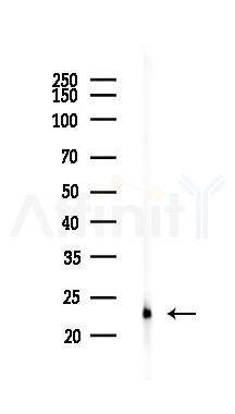 RhoA Recombinant Rabbit mAb - Western blot analysis of lysates from Rat spleen, using RhoA Recombinant Rabbit mAb at 1/1000 dilution.