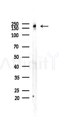 MUC2 Recombinant Rabbit mAb - Western blot analysis of lysates from COLO205 cells(starvation 24h treatment), using MUC2 Recombinant Rabbit mAb at 1/1000 dilution.