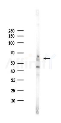 CaMKII Recombinant Rabbit mAb - Western blot analysis of lysates from Mouse brain, using CaMKII beta Recombinant Rabbit mAb at 1/1000 dilution.