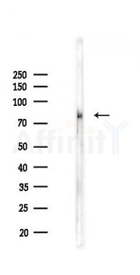 Phospho-CaMKII (Thr286) Recombinant Rabbit mAb - Western blot analysis of lysates from PC12 cells(LPS 4h treatment), using Phospho-CaMKII (Thr286) Recombinant Rabbit mAb at 1/1000 dilution.