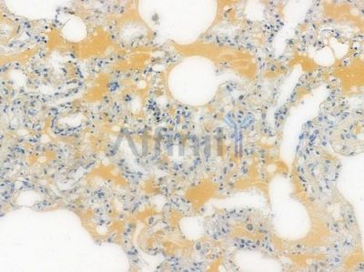 AGER/RAGE Recombinant Rabbit mAb - BF3259 at 1/100 staining human normal lung tissue by IHC-P.