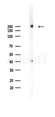 FASN Recombinant Rabbit mAb - Western blot analysis of lysates from PC12 cells(LPS 4h treatment), using Fatty Acid Synthase Recombinant Rabbit mAb at 1/1000 dilution.