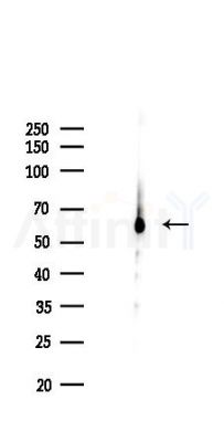 APG5L/ATG5 Recombinant Rabbit mAb - Western blot analysis of lysates from COLO205 cells(LPS,4h treatment), using APG5L/ATG5 Recombinant Rabbit mAb at 1/1000 dilution.