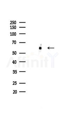 APG5L/ATG5 Recombinant Rabbit mAb - Western blot analysis of lysates from HepG2 cells(heat-shock,45min treatment), using APG5L/ATG5 Recombinant Rabbit mAb at 1/1000 dilution.