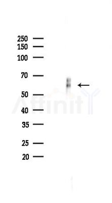 APG5L/ATG5 Recombinant Rabbit mAb - Western blot analysis of lysates from Rat lung, using APG5L/ATG5 Recombinant Rabbit mAb at 1/1000 dilution.
