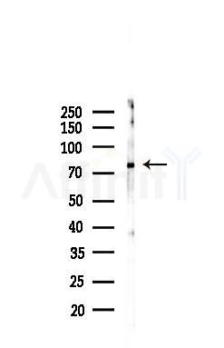 MFN1 Recombinant Rabbit mAb - Western blot analysis of lysates from B16F10-LUC cells(starvation,24h treatment), using Mitofusin 1 Recombinant Rabbit mAb at 1/1000 dilution.