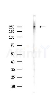 KAT3B/p300 Recombinant Rabbit mAb - Western blot analysis of lysates from PC12 cells(LPS 4h treatment), using P300/CBP Recombinant Rabbit mAb at 1/1000 dilution.