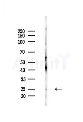 CD3E Recombinant Rabbit mAb - Western blot analysis of lysates from Rat brain, using CD3 epsilon Recombinant Rabbit mAb at 1/1000 dilution.