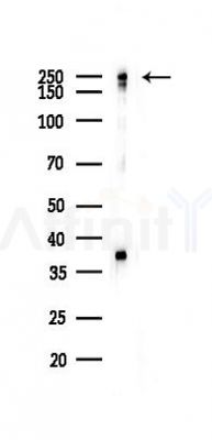 Nestin Recombinant Rabbit mAb - Western blot analysis of lysates from A2780 cells(LPS 4h treatment), using Nestin Recombinant Rabbit mAb at 1/1000 dilution.