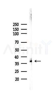 SCD1 Recombinant Rabbit mAb - Western blot analysis of lysates from HUVEC cells(LPS,4h treatment), using SCD1 Recombinant Rabbit mAb at 1/1000 dilution.