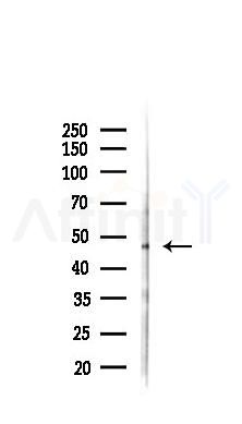 MyoD1 Recombinant Rabbit mAb - Western blot analysis of lysates from B16F10-LUC cells(starvation,24h treatment), using MyoD1 Recombinant Rabbit mAb at 1/1000 dilution.
