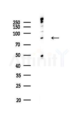 IKK beta Recombinant Rabbit mAb - Western blot analysis of lysates from EC304 cells(LPS,4h treatment), using IKK beta Rabbit mAb at 1/1000 dilution.