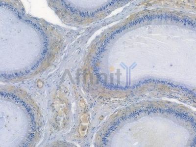 IKK beta Recombinant Rabbit mAb - BF3279 at 1/100 staining human testicular cancer by IHC-P.