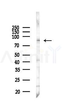 IKK beta Recombinant Rabbit mAb - Western blot analysis of lysates from COLO205 cells(heat-shock,45min treatment), using IKK alpha/beta Recombinant Rabbit mAb at 1/1000 dilution.