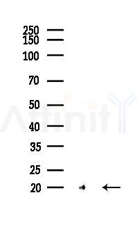 MLC2 Recombinant Rabbit mAb - Western blot analysis of lysates from Rat muscle, using Myosin Light Chain 2 Recombinant Rabbit mAb at 1/1000 dilution.