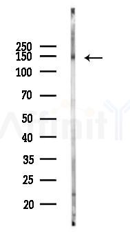 FGFR1 Recombinant Rabbit mAb - Western blot analysis of lysates from Rat brain, using FGFR1 Recombinant Rabbit mAb at 1/1000 dilution.