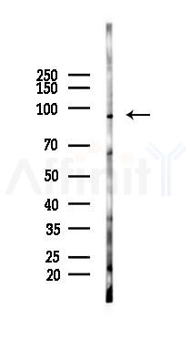 FGFR1 Recombinant Rabbit mAb - Western blot analysis of lysates from PC12 cells(LPS 4h treatment), using FGFR1 Recombinant Rabbit mAb at 1/1000 dilution.