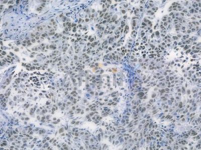 Phospho-MDM2 (Ser166) Recombinant Rabbit mAb - BF3284 at 1/100 staining human normal kidney tissue by IHC-P.