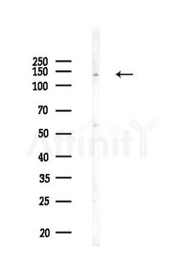 Trk B Recombinant Rabbit mAb - Western blot analysis of lysates from EC304 cells(LPS,4h treatment), using Trk B Rabbit mAb at 1/1000 dilution.
