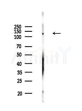 ACE2 Recombinant Rabbit mAb - Western blot analysis of lysates from Rat lung, using Angiotensin Converting Enzyme 2 Recombinant Rabbit mAb at 1/1000 dilution.