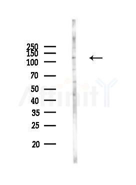 ACE2 Recombinant Rabbit mAb - Western blot analysis of lysates from EC304 cells(starvation 24h treatment), using Angiotensin Converting Enzyme 2 Recombinant Rabbit mAb at 1/1000 dilution.