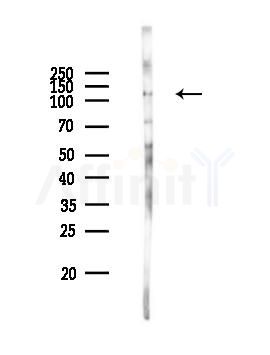 ACE2 Recombinant Rabbit mAb - Western blot analysis of lysates from RAW264.