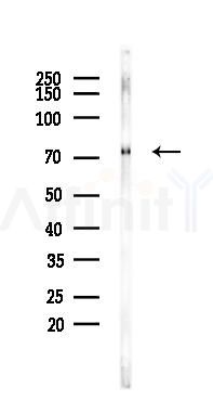 BMAL1 Recombinant Rabbit mAb - Western blot analysis of lysates from Rat muscle, using BMAL1 Recombinant Rabbit mAb at 1/1000 dilution.