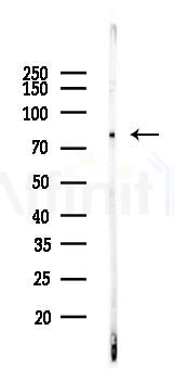 BMAL1 Recombinant Rabbit mAb - Western blot analysis of lysates from LoVo cells(heat-shock,45min treatment), using BMAL1 Recombinant Rabbit mAb at 1/1000 dilution.