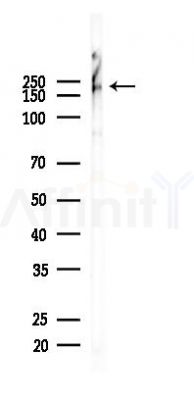 Phospho-MAP2 (Ser136) Recombinant Rabbit mAb - Western blot analysis of lysates from B16F10-LUC cells(heat-shock,45min treatment), using Phospho-MAP2 (Ser136) Recombinant Rabbit mAb at 1/1000 dilution.