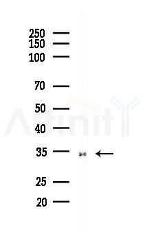 CDK4 Recombinant Rabbit mAb - Western blot analysis of lysates from B16F10-LUC cells(LPS, 4h treatment), using CDK4 Recombinant Rabbit mAb at 1/1000 dilution.