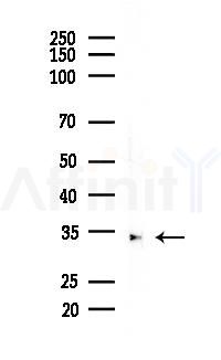 CDK4 Recombinant Rabbit mAb - Western blot analysis of lysates from COLO205 cells(heat-shock, 45min treatment), using CDK4 Recombinant Rabbit mAb at 1/1000 dilution.