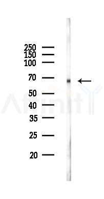 SYK Recombinant Rabbit mAb - Western blot analysis of lysates from COLO205 cells(heat-shock,45min treatment), using Syk Recombinant Rabbit mAb at 1/1000 dilution.