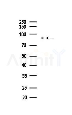 STAT5A Recombinant Rabbit mAb - Western blot analysis of lysates from B16F10-LUC cells(LPS,4h treatment), using STAT5a Recombinant Rabbit mAb at 1/1000 dilution.