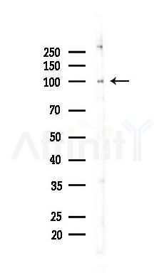 STAT5A Recombinant Rabbit mAb - Western blot analysis of lysates from HUVEC cells(LPS,4h treatment), using STAT5a Recombinant Rabbit mAb at 1/1000 dilution.