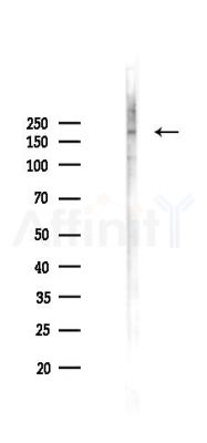 MYH7 Recombinant Rabbit mAb - Western blot analysis of lysates from PC12 cells(LPS 4h treatment), using heavy chain cardiac Myosin Recombinant Rabbit mAb at 1/1000 dilution.