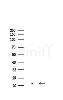 Glucagon Recombinant Rabbit mAb - Western blot analysis of lysates from A2780 cells(starvation 24h treatment), using GLP1 Recombinant Rabbit mAb at 1/1000 dilution.