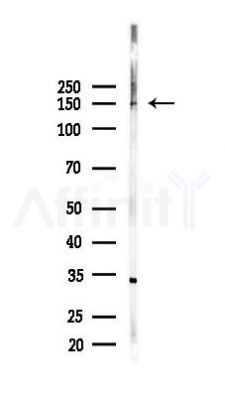 ROCK1 Recombinant Rabbit mAb - Western blot analysis of lysates from Hela cells(starvation,24h treatment), using ROCK1 Recombinant Rabbit mAb at 1/1000 dilution.