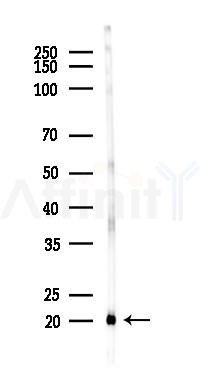 SOD1 Recombinant Rabbit mAb - Western blot analysis of lysates from Rat brain, using Superoxide Dismutase 1 Recombinant Rabbit mAb at 1/1000 dilution.