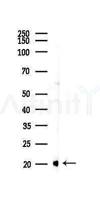 SOD1 Recombinant Rabbit mAb - Western blot analysis of lysates from Mouse liver, using Superoxide Dismutase 1 Recombinant Rabbit mAb at 1/1000 dilution.