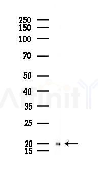SOD1 Recombinant Rabbit mAb - Western blot analysis of lysates from LoVo cells(heat-shock,45min treatment), using Superoxide Dismutase 1 Recombinant Rabbit mAb at 1/1000 dilution.
