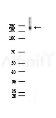 VEGFR1 Recombinant Rabbit mAb - Western blot analysis of lysates from Rat testis, using VEGF Receptor 1 Recombinant Rabbit mAb at 1/1000 dilution.