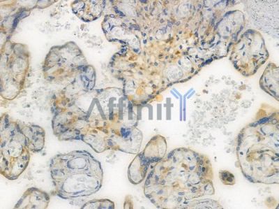 VEGFR1 Recombinant Rabbit mAb - BF3328 at 1/100 staining human normal placenta tissue sections by IHC-P.