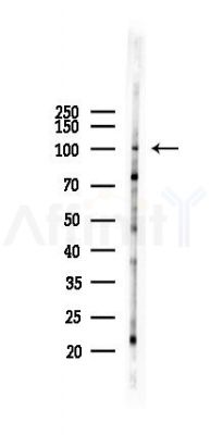 HIF-2-alpha Recombinant Rabbit mAb - Western blot analysis of lysates from Rat lung, using HIF-2-alpha Recombinant Rabbit mAb at 1/1000 dilution.