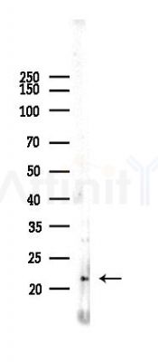 Ferritin Light Chain Recombinant Rabbit mAb - Western blot analysis of lysates from Mouse brain, using Ferritin Light Chain Rabbit mAb at 1/1000 dilution.